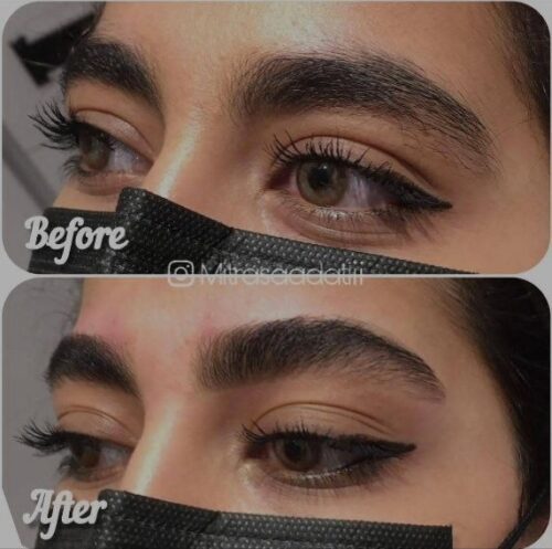 مشاور و اصلاح تخصصی ابرو